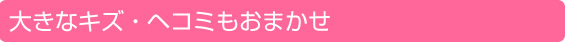 大きなキズ・ヘコミもおまかせ